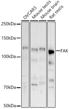 FAK Rabbit Polyclonal Antibody [KD Validated]