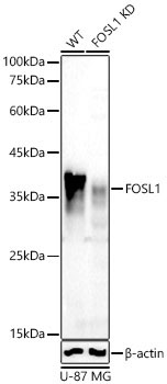 FOSL1 Rabbit Polyclonal Antibody [KD Validated]