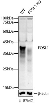 FOSL1 Rabbit Polyclonal Antibody [KD Validated]