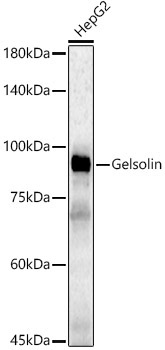 Gelsolin Rabbit Polyclonal Antibody [KD Validated]
