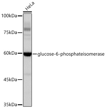 glucose-6-phosphate isomerase Rabbit Monoclonal Antibody [KD Validated]