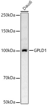 GPLD1 Rabbit Polyclonal Antibody [KD Validated]