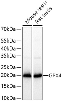 GPX4 Rabbit Polyclonal Antibody [KD Validated]