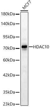 HDAC10 Rabbit Polyclonal Antibody [KD Validated]
