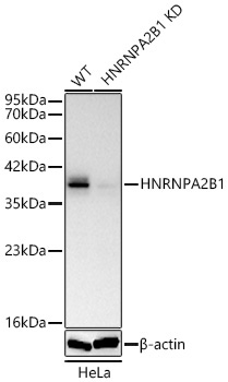 HNRNPA2B1 Rabbit Polyclonal Antibody [KD Validated]
