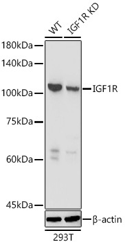 IGF1R Rabbit Polyclonal Antibody [KD Validated]