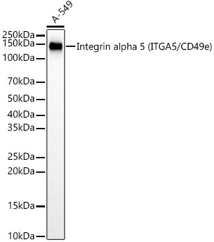 Integrin alpha 5 (ITGA5/CD49e) Rabbit Monoclonal Antibody [KD Validated]