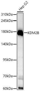 KDM2B Rabbit Polyclonal Antibody [KD Validated]