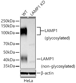 LAMP1 Rabbit Polyclonal Antibody [KD Validated]