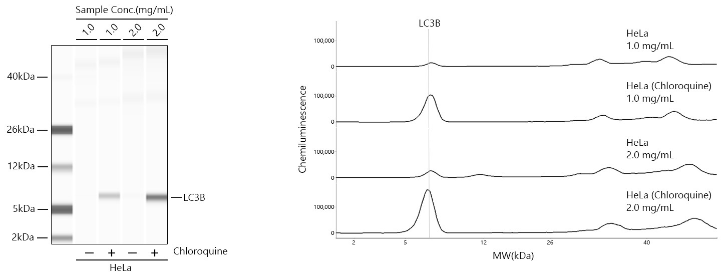 LC3B Rabbit Monoclonal Antibody [KD Validated]