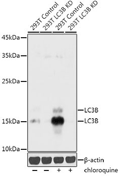 LC3B Rabbit Polyclonal Antibody [KD Validated]