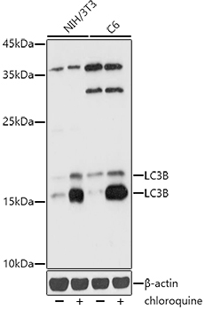 LC3B Rabbit Polyclonal Antibody [KD Validated]