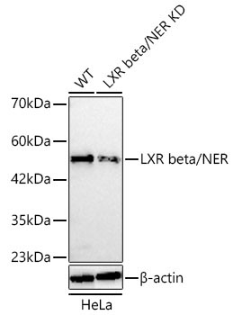 LXR beta/NER Rabbit Polyclonal Antibody [KD Validated]