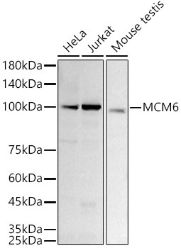 MCM6 Rabbit Monoclonal Antibody [KD Validated]
