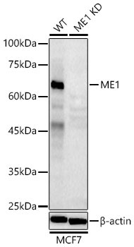 ME1 Rabbit Polyclonal Antibody [KD Validated]