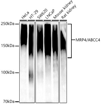 MRP4/ABCC4 Rabbit Monoclonal Antibody [KD Validated]