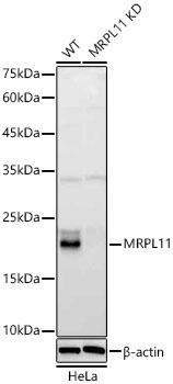MRPL11 Rabbit Polyclonal Antibody [KD Validated]