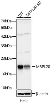 MRPL20 Rabbit Polyclonal Antibody [KD Validated]