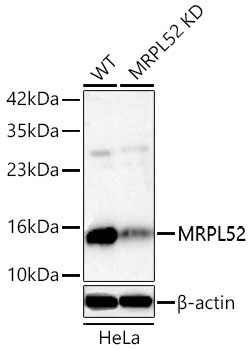 MRPL52 Rabbit Polyclonal Antibody [KD Validated]