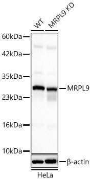 MRPL9 Rabbit Polyclonal Antibody [KD Validated]