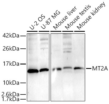 MT2A Rabbit Polyclonal Antibody [KD Validated]