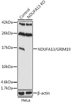 NDUFA13/GRIM19 Rabbit Polyclonal Antibody [KD Validated]