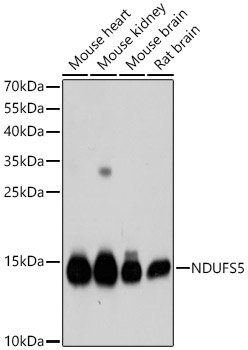 NDUFS5 Rabbit Polyclonal Antibody [KD Validated]