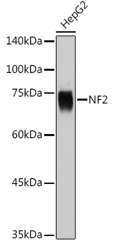NF2 Rabbit Polyclonal Antibody [KD Validated]