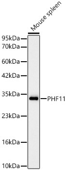 PHF11 Rabbit Monoclonal Antibody [KD Validated]