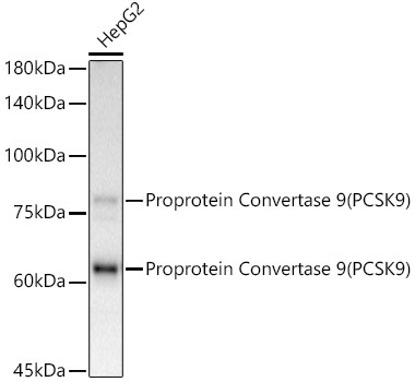 Proprotein Convertase 9(PCSK9) Rabbit Monoclonal Antibody [KD Validated]
