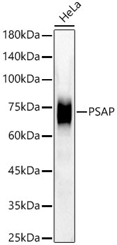 PSAP Rabbit Monoclonal Antibody [KD Validated]