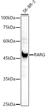 RARG Rabbit Polyclonal Antibody [KD Validated]