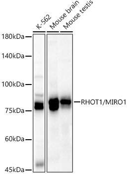 RHOT1/MIRO1 Rabbit Polyclonal Antibody [KD Validated]