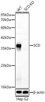 SCD Rabbit Polyclonal Antibody [KD Validated]