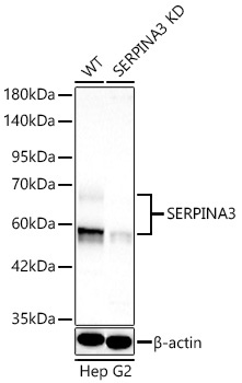 SERPINA3 Rabbit Polyclonal Antibody [KD Validated]