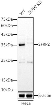 SFRP2 Rabbit Polyclonal Antibody [KD Validated]