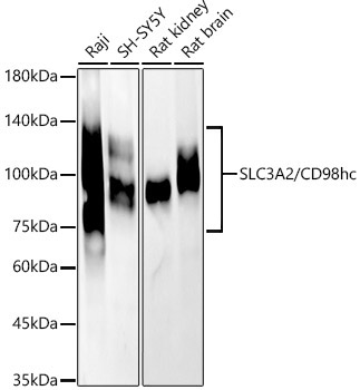 SLC3A2/CD98hc Rabbit Polyclonal Antibody [KD Validated]