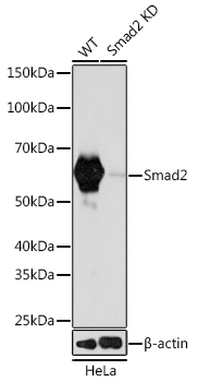 Smad2 Rabbit Monoclonal Antibody [KD Validated]