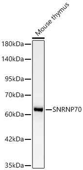 SNRNP70 Rabbit Monoclonal Antibody [KD Validated]