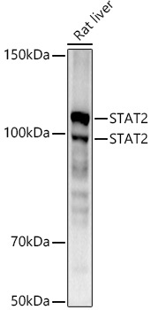 STAT2 Rabbit Monoclonal Antibody [KD Validated]