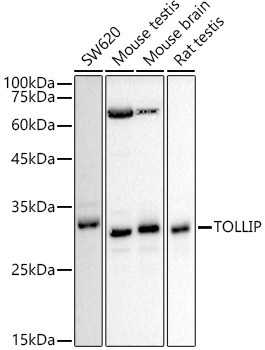 TOLLIP Rabbit Polyclonal Antibody [KD Validated]