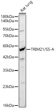 TRIM21/SS-A Rabbit Polyclonal Antibody [KD Validated]