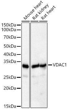 VDAC1 Rabbit Polyclonal Antibody [KD Validated]