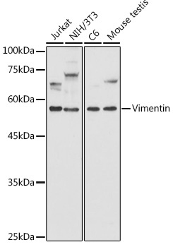 Vimentin Rabbit Polyclonal Antibody [KD Validated]