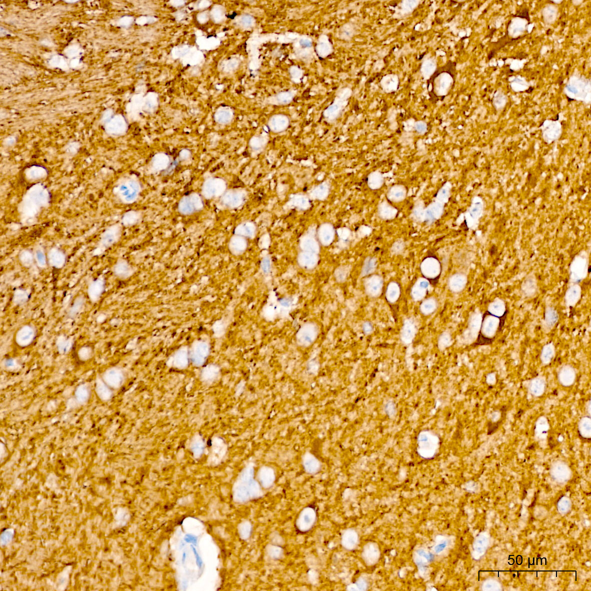 BetaIII-Tubulin Mouse Monoclonal Antibody [KD Validated]