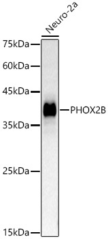 PHOX2B Rabbit Polyclonal Antibody [KD Validated]