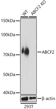 ABCF2 Rabbit Polyclonal Antibody [KO Validated]