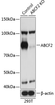 ABCF2 Rabbit Polyclonal Antibody [KO Validated]