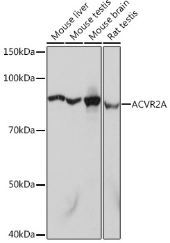 ACVR2A Rabbit Monoclonal Antibody [KO Validated]