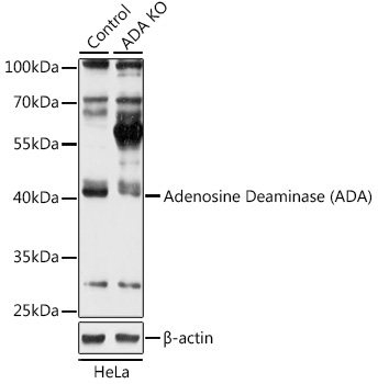 Adenosine Deaminase (ADA) Rabbit Polyclonal Antibody [KO Validated]